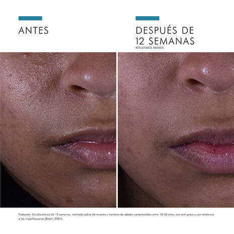 SKINCEUTICALS Silymarin CF
