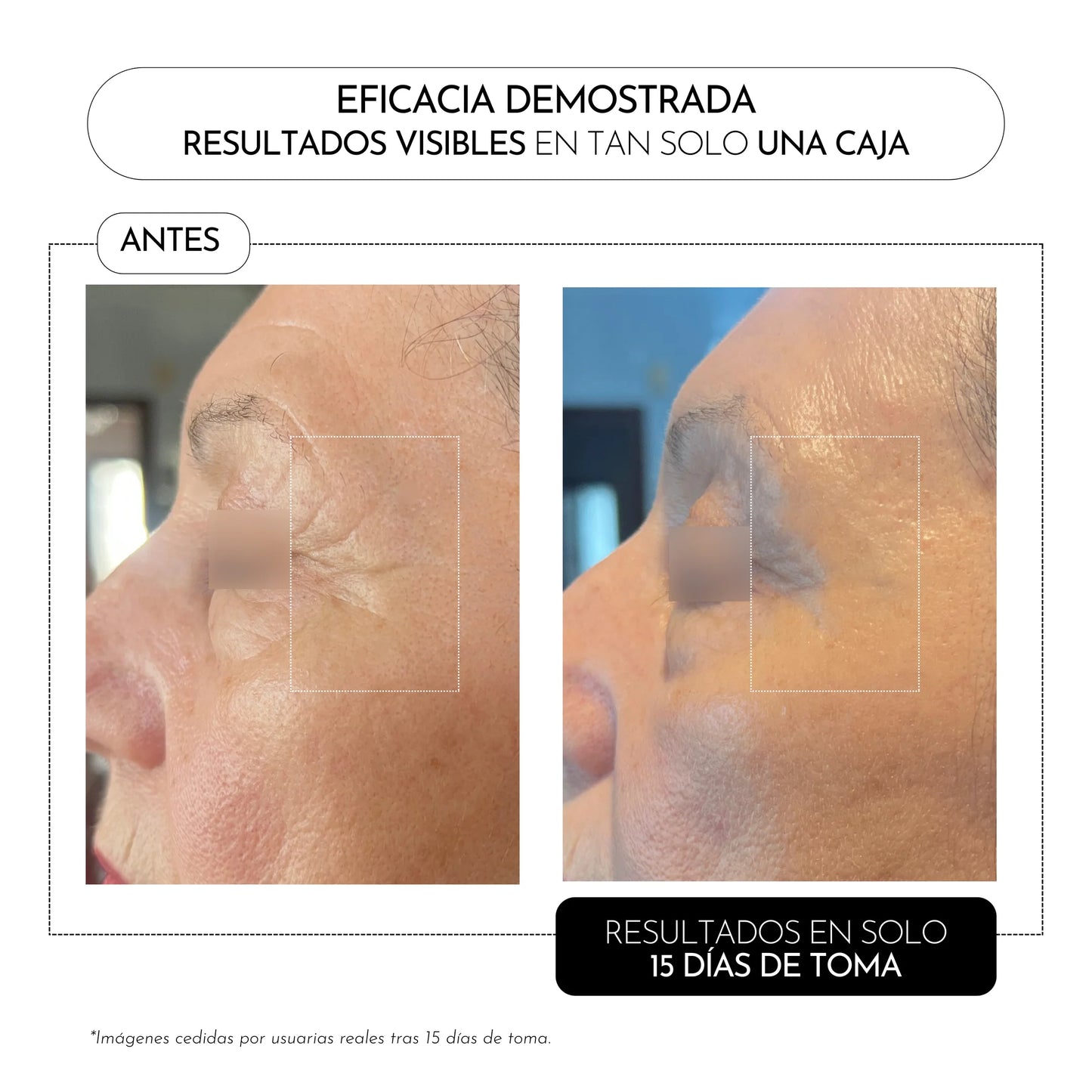 Luxmetique PROAGE day 15 viales
